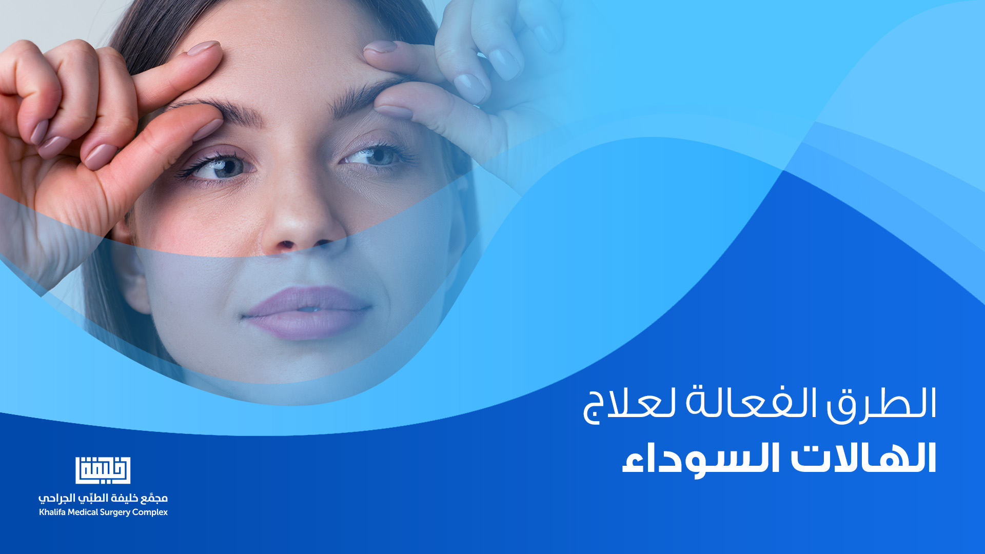 ما هي اسباب الهالات السوداء وما هي الطرق الفعالة لعلاجها